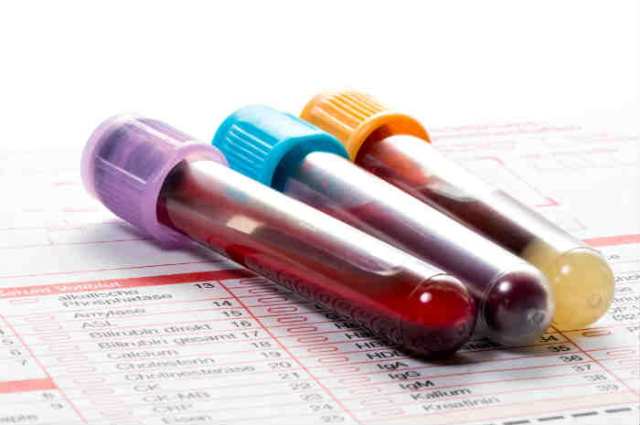 ESAMI DEL SANGUE: info utili
